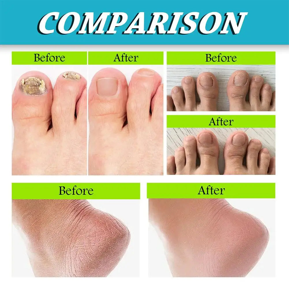 30ml Foot Care Spray Natural Deodorizing Podiatry Spray Cleansing Foot Skin Dead Remove Care Exfoliator Anti-crack A6I3